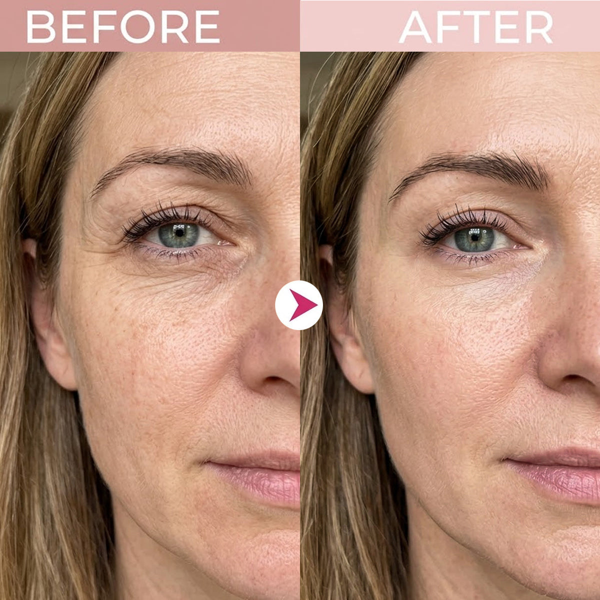 P7 Eye Renewal Crème